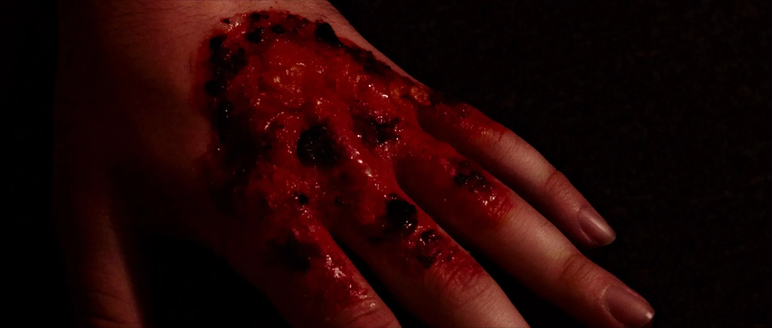Bloodied hand with visible wounds, in need of medical attention.